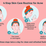 How to manage acne with skincare products